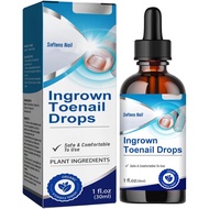 Ingrown Toenail Liquid - 30ML Ingrown Toenail Correction Drops - Nail Helper Ingrowth Toenail Oil - 