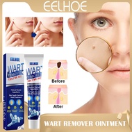 Eelhoe Wart Remover Ointment Wart Treatment Remover Antibacterial Foot Corn Repair cream (20g)