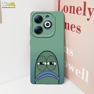 Case Untuk Infinix Smart 8 / Smart 8 Pro - Eksotik - Casing Infinix Smart 8 / Smart 8 Pro - Bahan Le