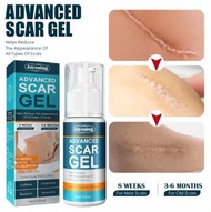 其他品牌 - 去疤痕凝膠 除疤去印 產後妊娠紋疤手術修復霜 50ml