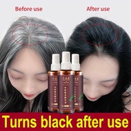Spray Rambut OMENFEE spray penghilang uban Pelebat rambut Spray anti gugur Cegah rambut gugur preven