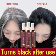 Spray Rambut OMENFEE spray penghilang uban Pelebat rambut Spray anti gugur Cegah rambut gugur preven