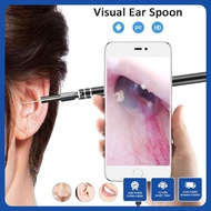 3-in-1 Ear, Nose, Throat Endoscopic Instrument, HD Camera, Phone App Connection