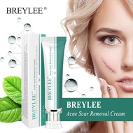 BREYLEE Scar Cream Face Pimples Scar Stretch Marks Removal Whitening Moisturizing Cream Skin Care 30g Face Cream Skin Repair 30g 1