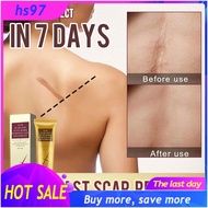 scar remover for old scar on leg bio oil stretch mark remover peklat scars remover cream original ma