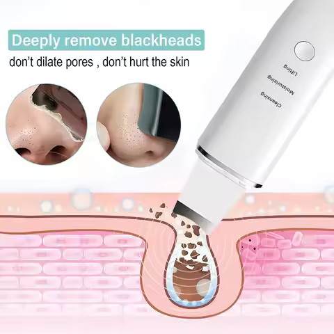 Ultrasonic Facial Skin Scrubber Deep Facial Cleansing Device Blackhead Acne Removal High Frequency V