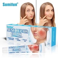 Sumifun祛痘膏 修复痘痘肌肤淡化痘印保湿 Krim Jerawat Merawat Kulit Berjerawat Pudar Parut Acne Cream Repairs Acne-Pr