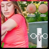 Painless mosquito bite suction device
