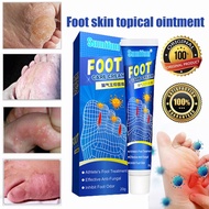 ubat kulat kaki ubat kaki Kaki mengelupas Kulat air Kaki gatal berbau Foot fungus Sumifun beriberi i