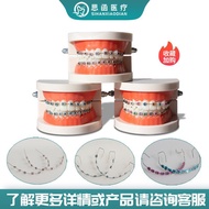 Communication Dental Display Tray Dental Mold Dental Metal Tray Oral Doctor's Clinic Model Model S7S