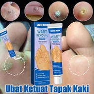 barang asli Ubat Ketuat Tapak Kaki Ubat Mata Ikan Penampal Ketuat Remover Foot Corn Remover Wart Rem
