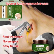 【Buy 2 Get 1 Free】Natural Herbal Lipolysis Cream | Lipoma & Skin Cyst Care | Fast-Acting Formula (30