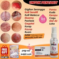Ubat Kurap Gatal Kayap Kulit Sensitif Kudis Psoriasis Scabies Itchy Ringworm Ulat Air Sensitive Skin