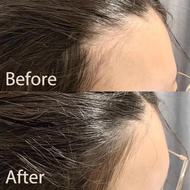 Hairline Filling Powders 2g Natural Black/gray/light Brown Colors Covers Waterproof Sweatproof U9v4