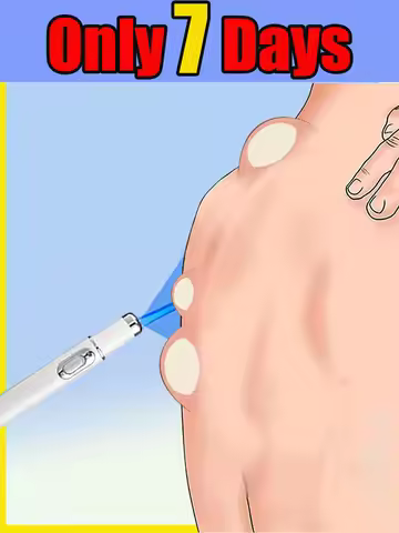 Newly upgraded blue laser pen for skin care, gently caring for every inch of your skin