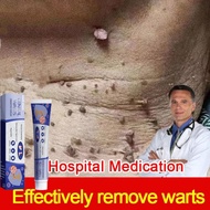 ubat ketuat remover warts remover Corns Calluses ubat ketuat tapak kaki ubat kutil removal biji kole