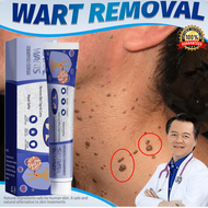 wart removal skin tag removal wart cream Wart Removal Ointment cream mole removal cream mole remover tahi lalat remover ubat hilangkan tahi lalat 20g 点痣药膏