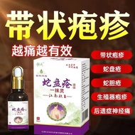 蛇盘疮专用带状疱疹后遗症神经痛飞蛇缠腰龙外用疱疹膏蛇胆疮液Snake disc sore Special herpes zoster Sequelae Neuralgia20260705