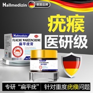 Hallmedizin Flat Euro Removal Ointment Metatatatatatatasal Warts Remove Euro Small Meat Granules Fil