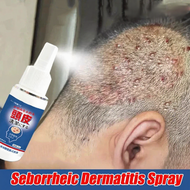 Seborrheic Dermatitis Scalp Spray – 30ml Treatment for Psoriasis, Dandruff & Itchy Scalp