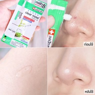  Pro Strong Second Acne gel Clear Nose 4g Sachet X7 Pieces (AGS 6 + 1)