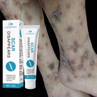 Scar removal cream Krim hilangkan parut hitam hilangkan parut kaki parut kudis hitam krim parut luka