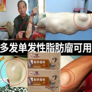 6 stickers/box Lipoma stickers Lipoma Removal Cream Lipoma Patch Anti-Tumor Peeling Pain Relief Patc