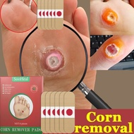 Foot corn remover Wart remover corn removal patch 雞眼貼 painless removal corn wart st Hands and Feet F