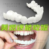 🔥爆款~牙套🔥美白牙套 吃飯神器 補牙 臨時假牙貼片 仿真牙齒 矽膠鍍膜 龅牙缺門牙縫遮蓋