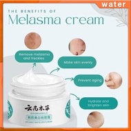 Wateryy Whitening Freckle Cream Pekas Remover Melasma Cream Anti Dark Spot Brighten Skin 30g