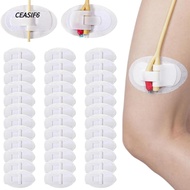 CEASIF6 Catheter Fixation Sticker, Breathable Adhesive Urinary Tube Holders,  Disposable Catheter St
