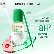 [NEW LAUNCH] SKINTIFIC Acne Drying Lotion Salicylic Acid Acne spot treatmen Acne Scar Serum Essence