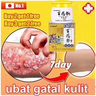 eczema psoriasis cream antifungal anti itch Bai Yao Lang Cream private part itchy cream