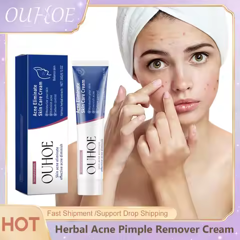 Pimple Acne Treatment Face Cream Nourish Balance Oil Control Refreshing Repairing Pimple Remover Acn