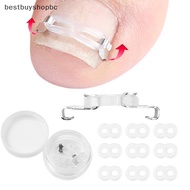 1/2 Set Ingrown Toenail Corrector Tools Pedicure Recover Embed Toenail Treatment Professional Foot C