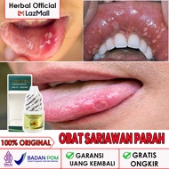 PROPOLIS Asli Obat Sariawan Akut Sariawan Parah - Sariawan Radang - Sariawan Berdarah - Sariawan Men