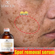 whitening dark spot serum krim jeragat anti freckle essence 美白祛斑精华 Lightens facial melanin inhibitio