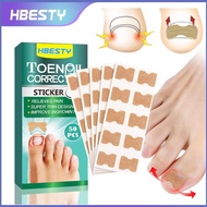 HBESTY Ingrown Toenail Corrector Strips