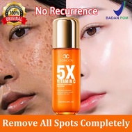 Dark spot fading serum – Dark Spot Remover, Freckle and Pigmentation Treatment, Brightening Skincare
