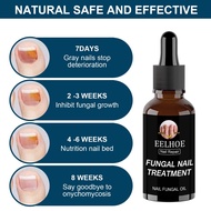 Eelhoe Nail Repair Solution Antibacerial Nail Fungus Treatment Nail Repair Liquid Paronychia Nail Re