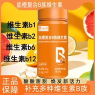 OEM Complex Vitamin B Complex Vitamin B Complex Vitamin c Calcium Iron Zinc Special Diet Nutrition S