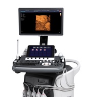 cheapest portable echocardiography 4d color doppler ultrasound therapy machine ultrasonido price