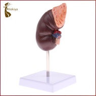 [kokiya] 1:1 Human Removable 2 Parts Kidney With Adrenal Gland Model School Teaching Display Lab Sup