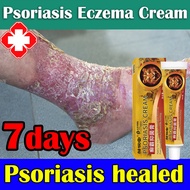 Psoriasis Eczema Soriasis Treatment Cream And Ointments For Skin allergy Deases hydrocortisone derma