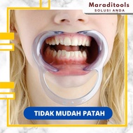 Blue INTRAORAL C Shape Mouth Opening Tool CHEEK RETRACTOR MOUTHGATE Dental Jaw Support