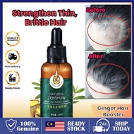 【🇲🇾 24h】Ginger King Hair Growth Serum ginger hair growth tonic Tumbuh Rambut rambut gugur serum ramb