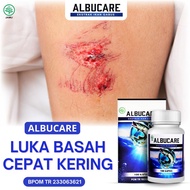 Obat Herbal Luka Diabetes ASLI - Pengering Luka Basah - Obat Diabetes Basah - Diabetes Kering - Luka