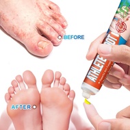 ATHLETES FOOT CREAM Krim kaki atlet anti bau kaki peluh gatal kaki Krim Anti-Kulat penghilang gatal 