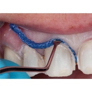 Singapore elite thread picker nksg