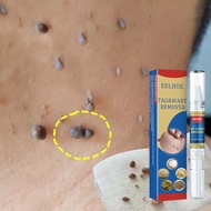 Warts Flat Eliminate Wart Pen Wart Liquid Hand Foot Warts Remove Filiform Flat Warts Condyloma Acumi